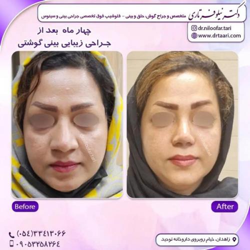 جراحی-بینی295