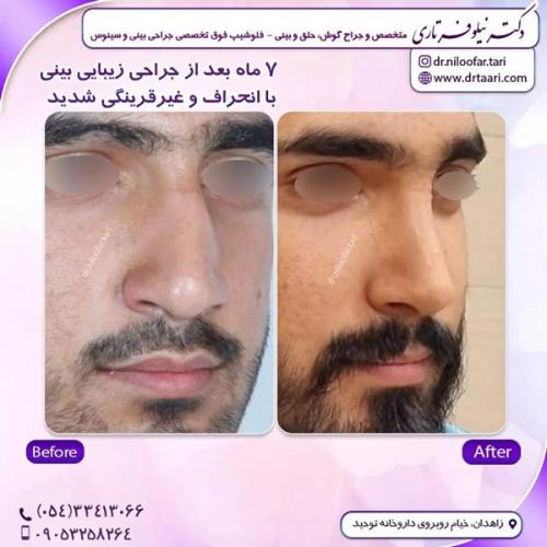 جراحی-بینی296