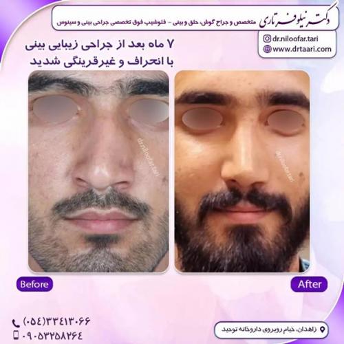 جراحی-بینی297