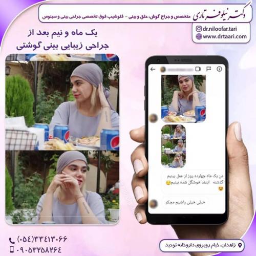 جراحی-بینی298