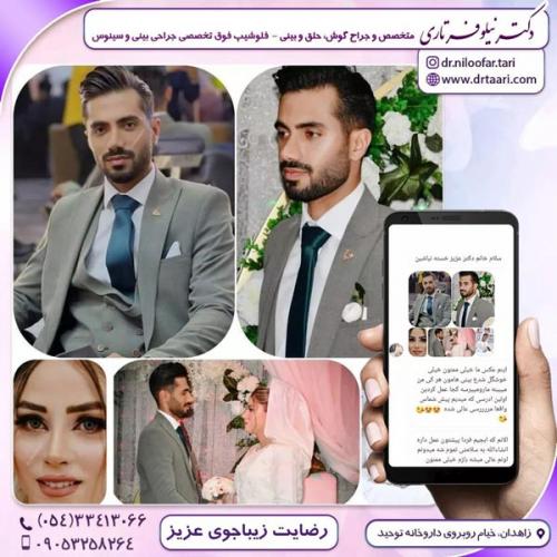 جراحی-بینی299