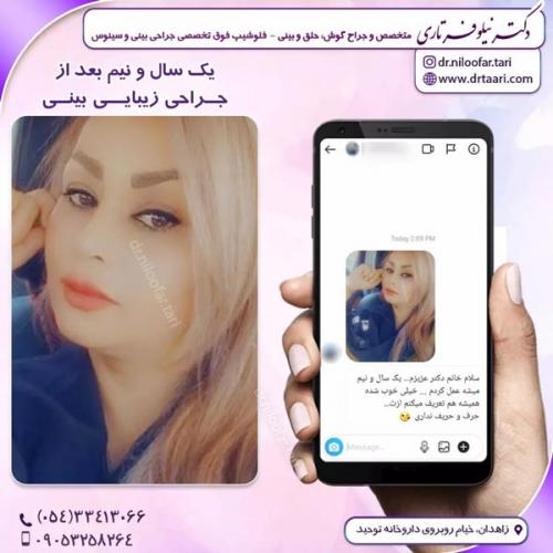 جراحی-بینی300