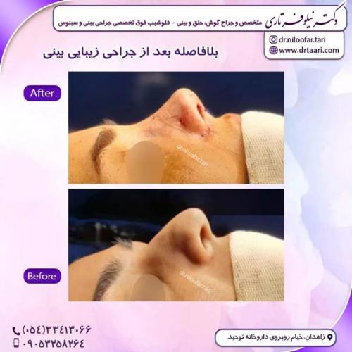 جراحی-بینی301