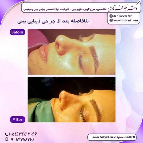 جراحی-بینی304