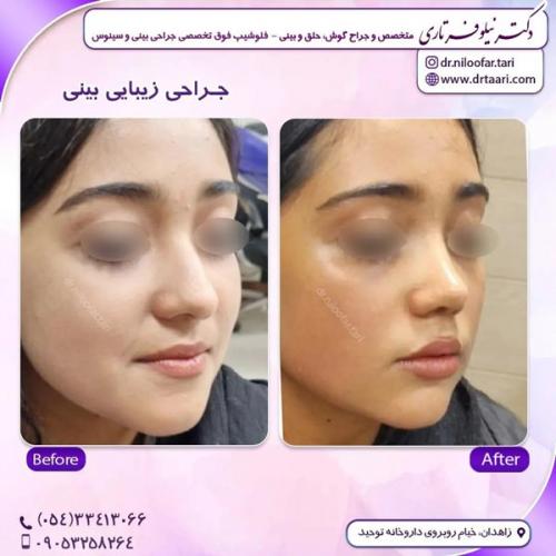 جراحی-بینی307