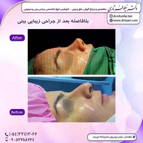 جراحی-بینی308