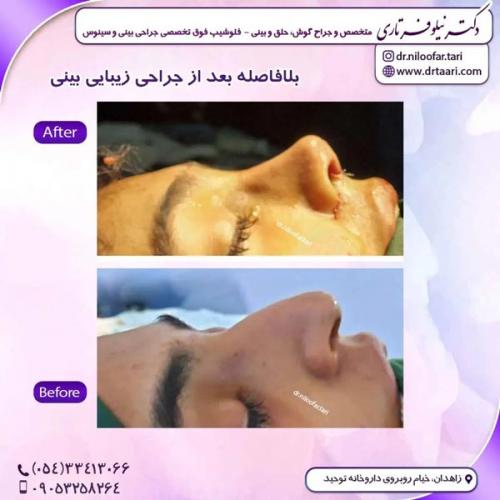 جراحی-بینی312