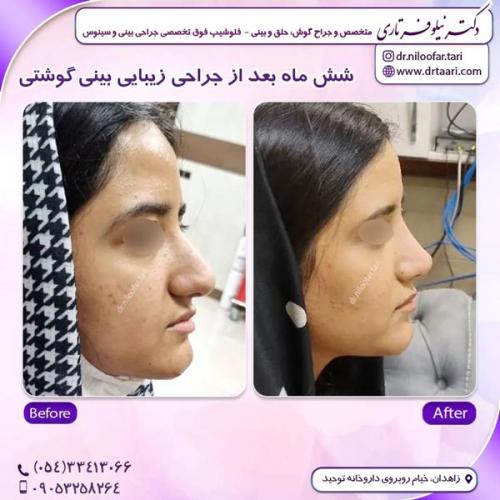 جراحی-بینی313