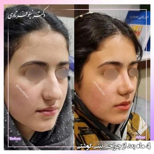 جراحی-بینی327