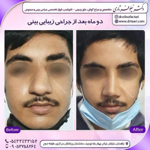 جراحی بینی 285 (1)
