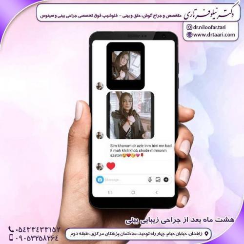 جراحی بینی 285 (12)