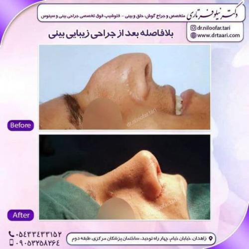 جراحی بینی 285 (43)