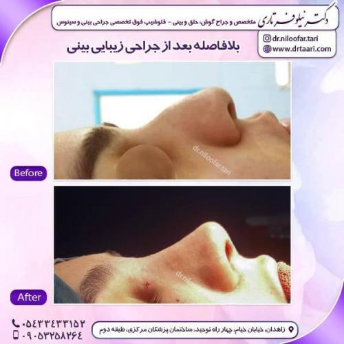 جراحی بینی 285 (47)
