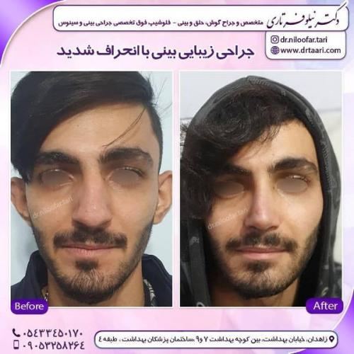 جراحی بینی 285 (58)