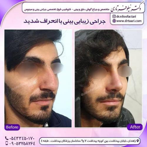 جراحی بینی 285 (59)