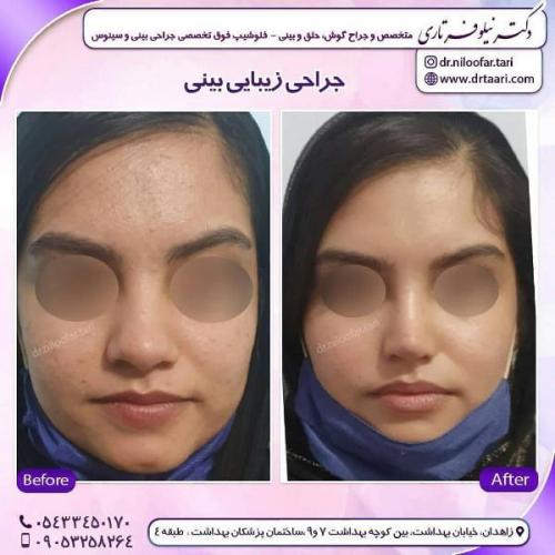 جراحی بینی 285 (72)