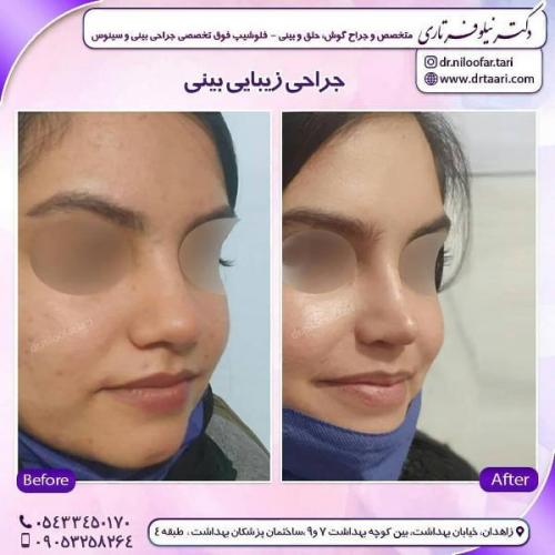جراحی بینی 285 (73)